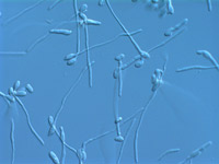 Ascopspore germination