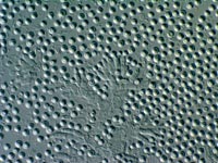 Phialospores