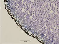 Sclerotium Cross Section